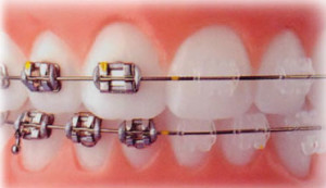 ortodonzia